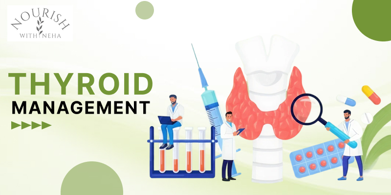 Thyroid Management